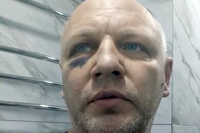 Геннадий Бирюков со следами избиения на лице. Скриншто видео: tiktok.com/@user1838557947359