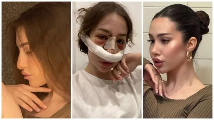 Диана мечтала изменить нос еще со школы. Фото из личного архива